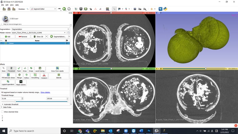 3D Slicer interface