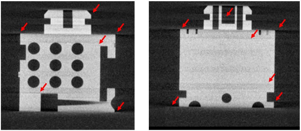 streaking artifacts-min