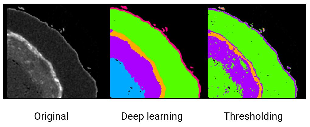 microparticle X-ray CT scan segmentation comparison